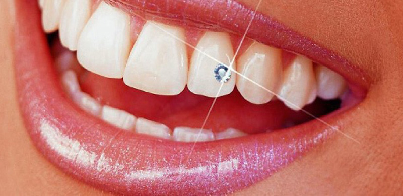 teethjewellery